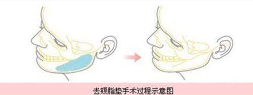 六、杭州大麦整形外科门诊部（大麦微针植发）：预约指南与贴心服务，变得更美更省心