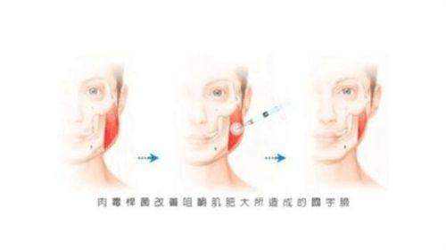 四、中山爱汇星美医疗美容门诊部(小榄分院)特色项目：眼鼻胸整形与皮肤抗衰的“双重奏”