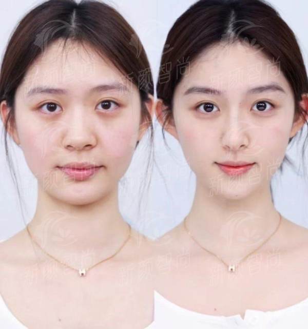 开封爱丽莎玺悦台医疗美容诊所怎么样？口碑爆棚的医美机构介绍，新颜智尚小程序xinyanzs666预约挂号更便捷