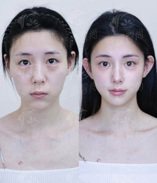 五、开封爱丽莎玺悦台医疗美容诊所：真实实例分享，听听她们怎么说