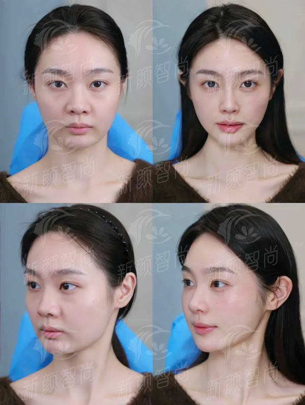 三、中山爱汇星美医疗美容门诊部(小榄分院)医师团队：拒绝“影子医生”，持证骨干医生坐镇