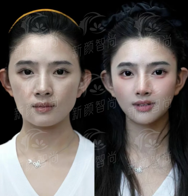 三、徐州星晨妇儿医院(星晨医美中 心)——产科天团坐镇，LDRP一体化产房实现快乐分娩