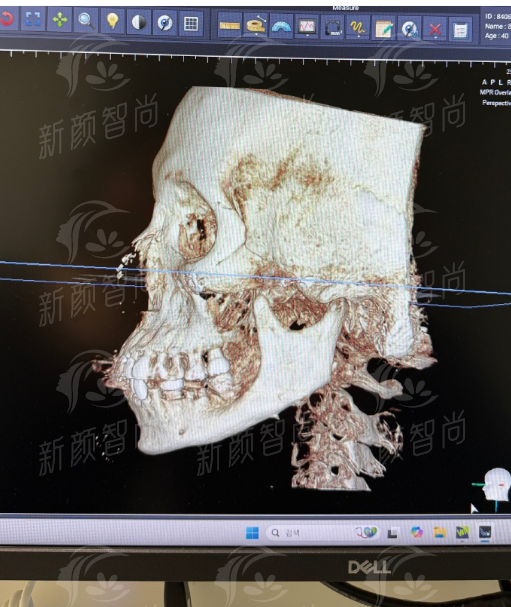 七、辽阳鞍山燕丽医疗美容诊所：预约挂号指南，开启你的变得更美之旅