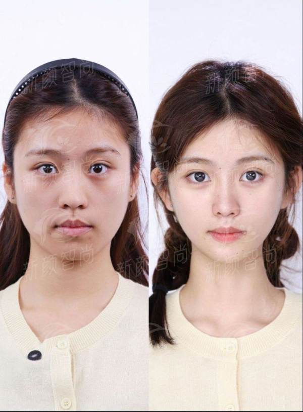 三、辽阳鞍山燕丽医疗美容诊所：中韩名咖坐镇，正规资质才是护身符