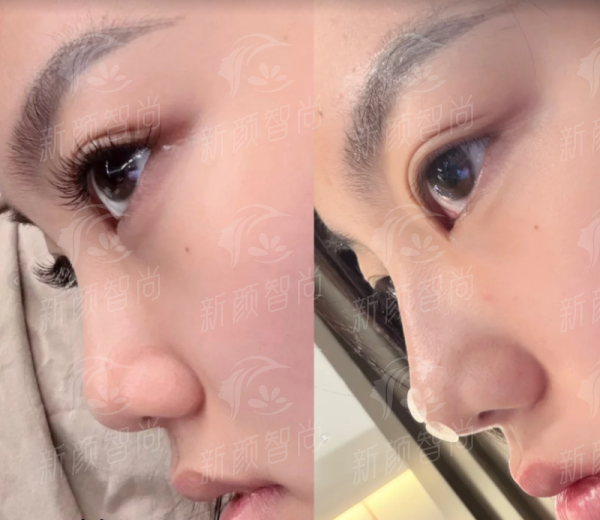北海韩美医疗美容医院怎么样？专业医生团队+先进设备，效果看得见！新颜智尚小程序xinyanzs666预约挂号更便捷