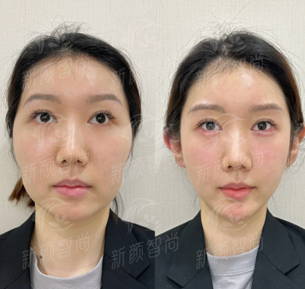四、深圳医恒美医疗美容诊所——明星项目与真实口碑的双重认证
