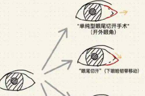 韩国布莱克植发医院怎么样？技术优势与价格解析，新颜智尚小程序xinyanzs666预约挂号更便捷