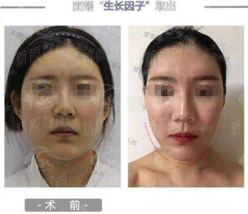 六、<strong>长沙菲澜千熹医疗美容门诊</strong>：预约挂号指南，轻松开启美丽之旅