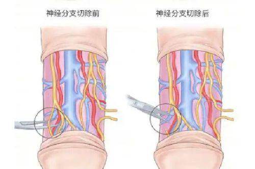 三、韩国布莱克植发医院医生：辛东泌院长领衔，拒绝影子医生
