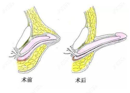 四、BTN皮肤科医院 & 伊美芝皮肤科：色素管理与注射美学的“双杰”