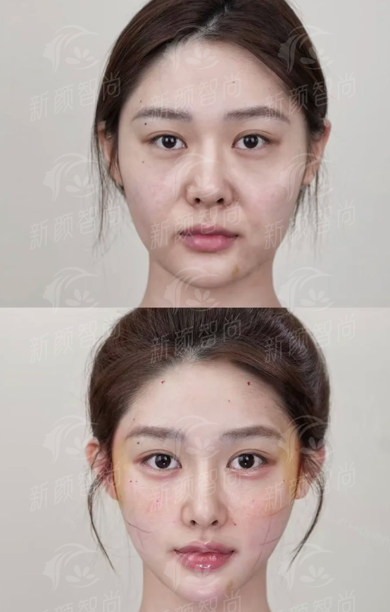 金华薇琳医美医院怎么样？专家团队+进口设备，新颜智尚小程序xinyanzs666预约挂号更便捷