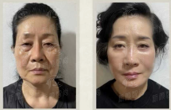 五、韩国德丽珍TheRegen整形医院2026价格表与VIP服务：贵在品质，值在体验