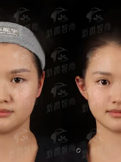 四、<strong>长沙菲澜千熹医疗美容门诊</strong>：真实实例分享，集美们的变得更美心声