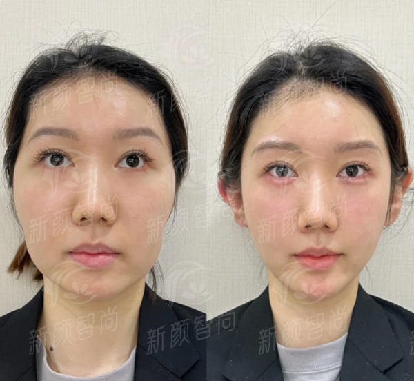 三、武汉妍妍子新至美医疗美容门诊部:实力派医生团队与“脂肪移植”绝活