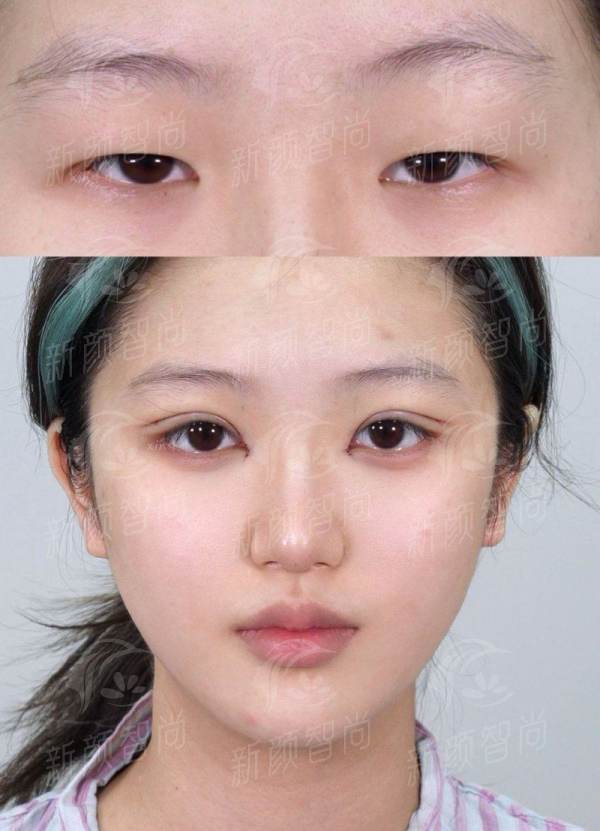 七、<strong>韩国moon皮肤科医院</strong>：预约攻略与服务，让你跨国变得更美无忧