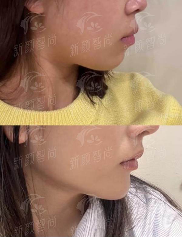 四、武汉妍妍子新至美医疗美容门诊部:VIP级的人性化服务与术后关怀