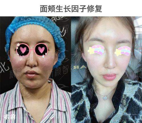 武汉恩吉娜中爱医疗美容医院怎么样？看这篇就够！附新颜智尚小程序xinyanzs666预约挂号更便捷