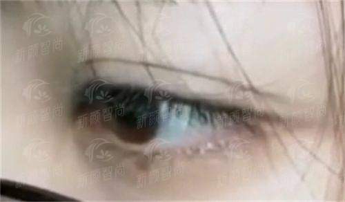 三、上饶驻颜医疗美容门诊部项目优势:眼鼻胸皮肤,一站式定制