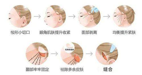 六、天津星颜医疗美容(梅江院区)：避坑指南与预约通道