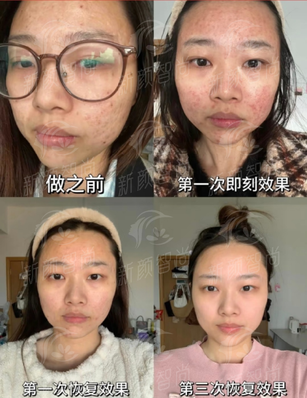 四、上海绿之星医疗美容诊所:拒绝套路,坚守合规底线