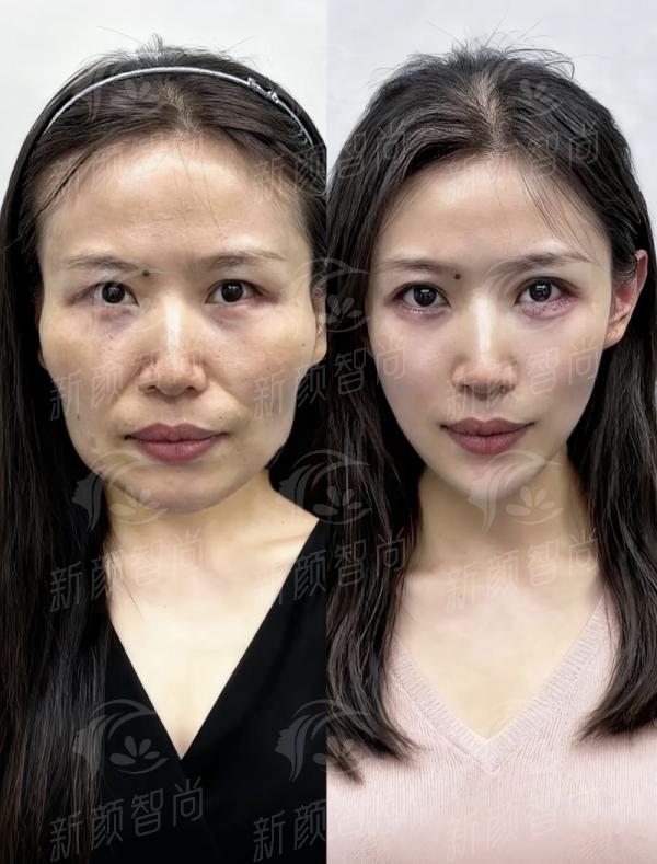 岳阳新颜医疗美容医院怎么样？岳阳口碑医美机构盘点，附新颜智尚小程序xinyanzs666预约挂号更便捷