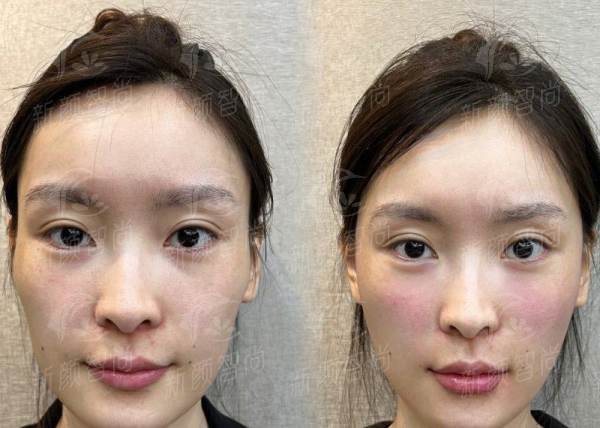 六、贵阳华榕序医疗美容诊所：预约挂号指南，开启变得更美之旅