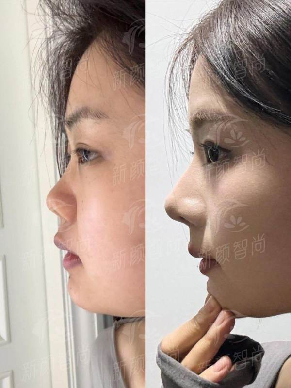 三、泸州泸美医疗美容诊所安心:资质核查,医疗级轻变得更美的底气