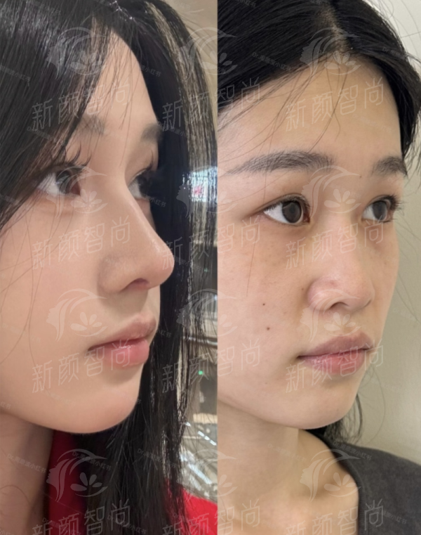 三、贵阳华榕序医疗美容诊所：严苛医疗标准，科技美学新定义