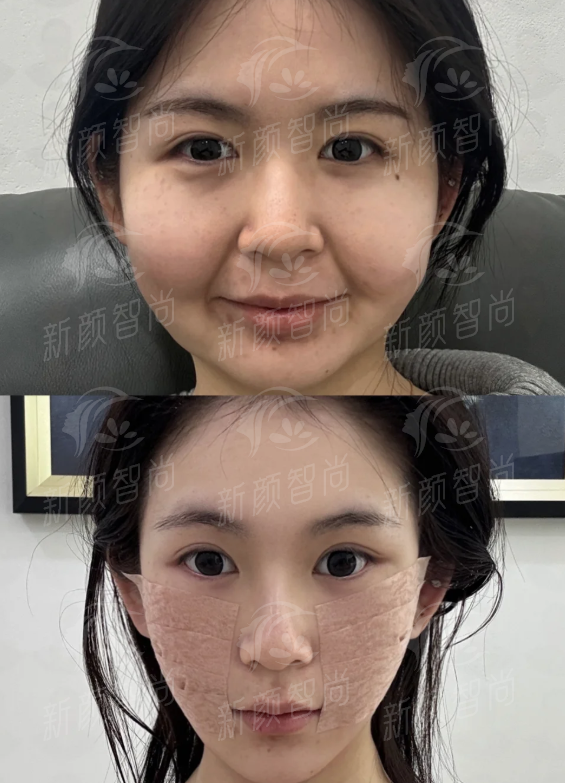 四、天津星颜医疗美容(南开旗舰店)：严选医生资质，技术交付才是硬道理