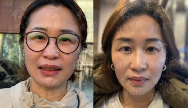 二、上饶驻颜医疗美容门诊部医生团队:严选骨干医生,拒绝“影子医生”
