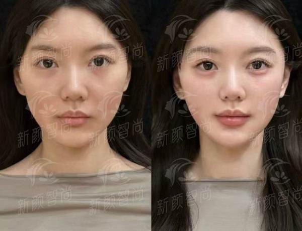 四、成都美茵医疗美容价格表2026：透明消费，拒绝钱包刺客