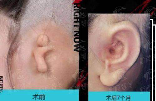 二、汕头大学医学校第一附属医院(医学美容中 心):博士天团坐镇,拒绝“半路出家”