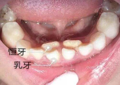 二、石河子大学第一附属医院烧伤整形科：名咖云集，技术流才是yyds