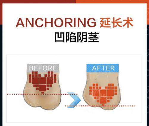 三、广东医 科 大学附属医院(整形外科)：AI赋能精细诊疗，脉管疾病治疗的“智慧大脑”