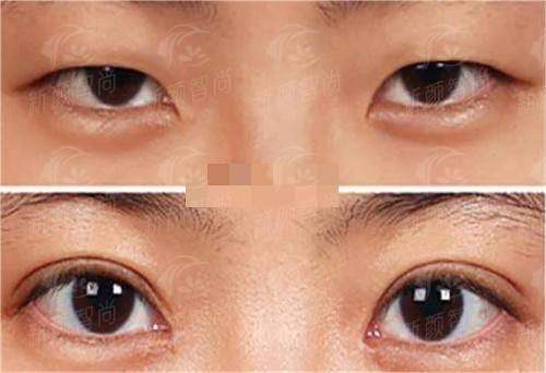 五、2026年三亚医美项目价格表参考：明码标价不踩坑