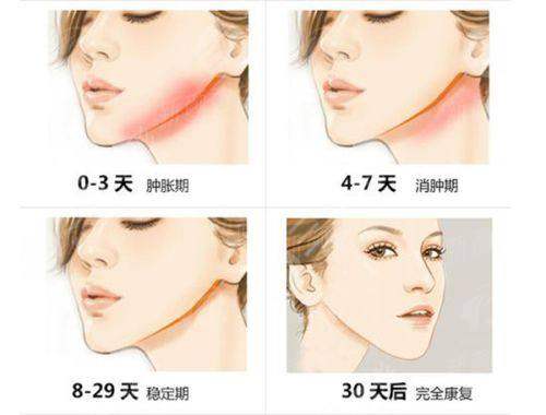 五、汕头大学医学校第一附属医院(医学美容中 心):真实实例分享,听听她们怎么说