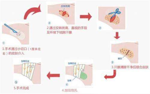四、龙岩市第二医院烧伤整形美容科：烧伤修复与创面治疗，不仅仅是变得更美更是“救命”