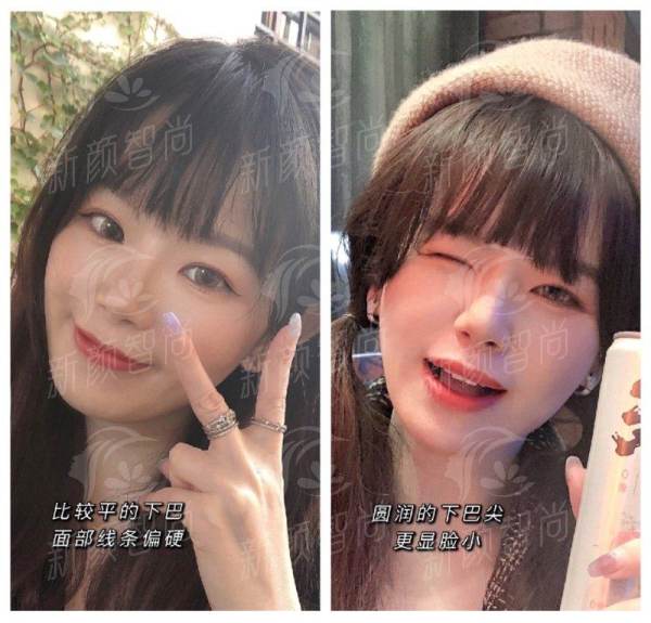 四、三亚求美者真实实例：她们在三亚悄悄变得更美了