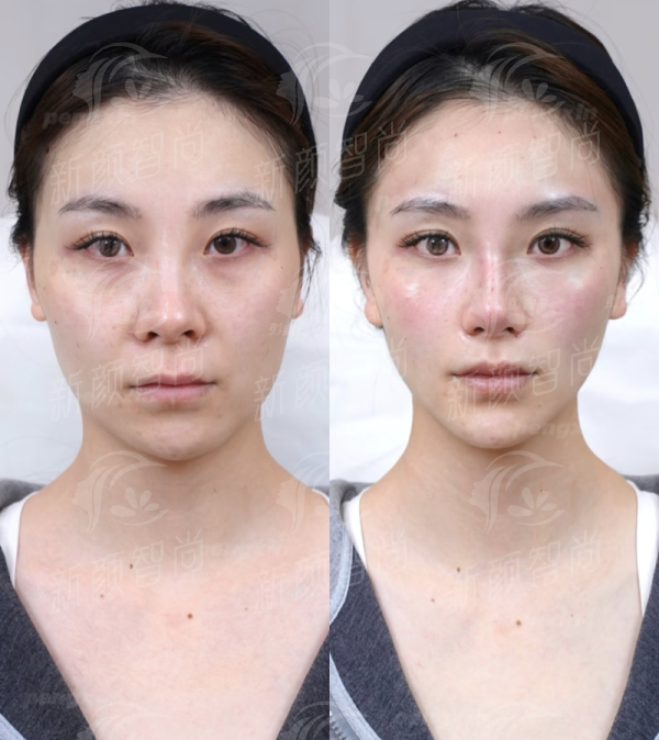 探秘暨南大学附属第一医院整形美容中心!特色项目与真实体验,上新颜智尚小程序挂号不踩坑