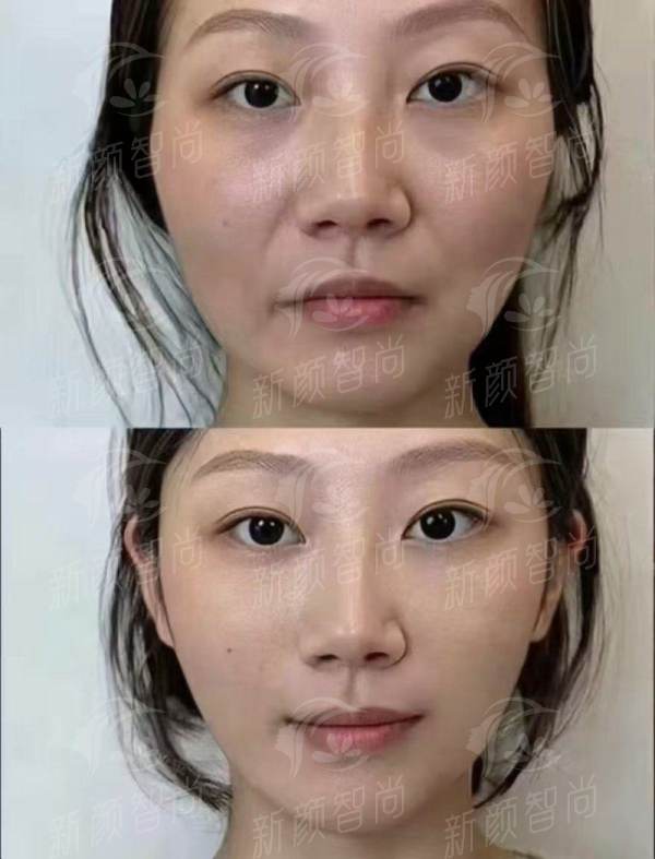 二、龙岩市第二医院烧伤整形美容科：卢占洲领衔，科班出身的“美学操盘手”
