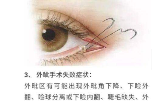 六、河北省眼科医院 预约挂号指南，拒绝排队烦恼