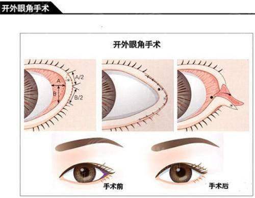 四、<strong style="color: red;">承德医学校附属医院(医疗美容科)</strong>：2026年全新价格表，透明公道不踩坑