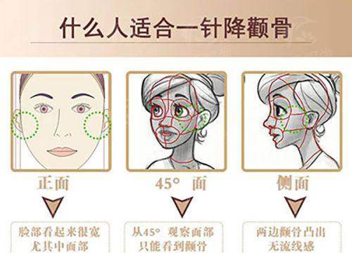 六、杭州师范大学附属医院(烧伤整形美容科)就诊指南：预约与交通