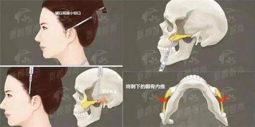 三、遵义医 科 大学第二附属医院：孙广峰医生与他的“指尖艺术”