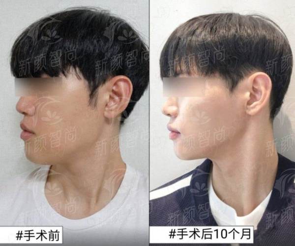 五、石家庄市妇产医院医疗美容科：私密“焕新”，重拾女性自信