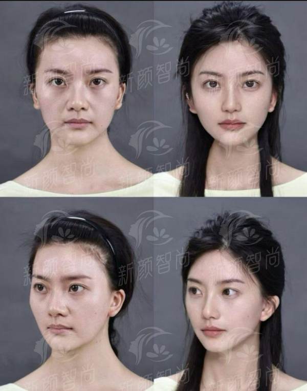 三、石家庄市妇产医院医疗美容科：硬核设备“全家桶”，拒绝“智商税”