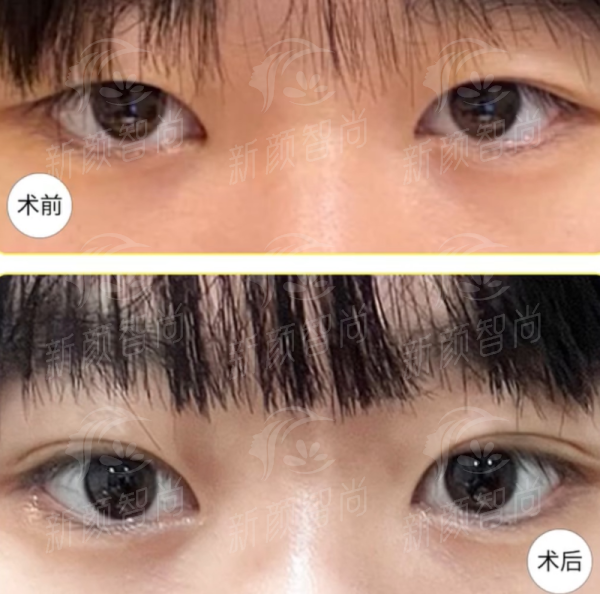 二、河北省眼科医院 硬核设备与骨干医生团队，技术咖的专属配置
