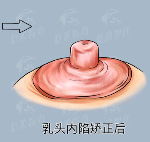 六、为什么选择泉州市第一医院整形科?五大理由告诉你