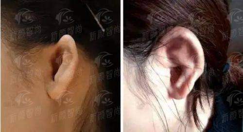 三、真实实例分享:在长兴悦美,他们如何实现美丽蜕变?