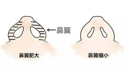 二、技术硬核:背靠上海九院,脂肪移植等特色项目领跑泉州